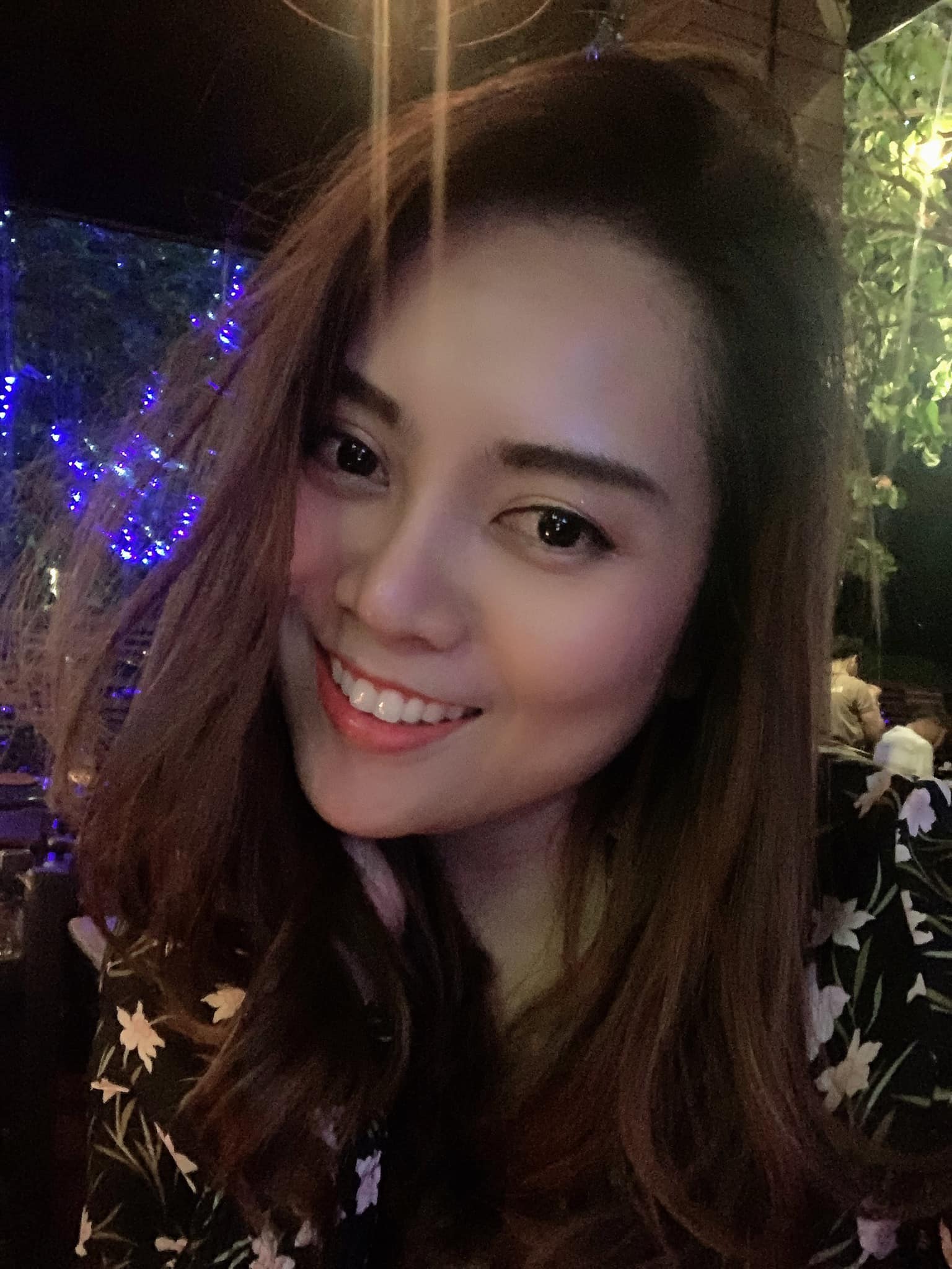 รีวิวจัดฟันใส อินโนอะไลน์