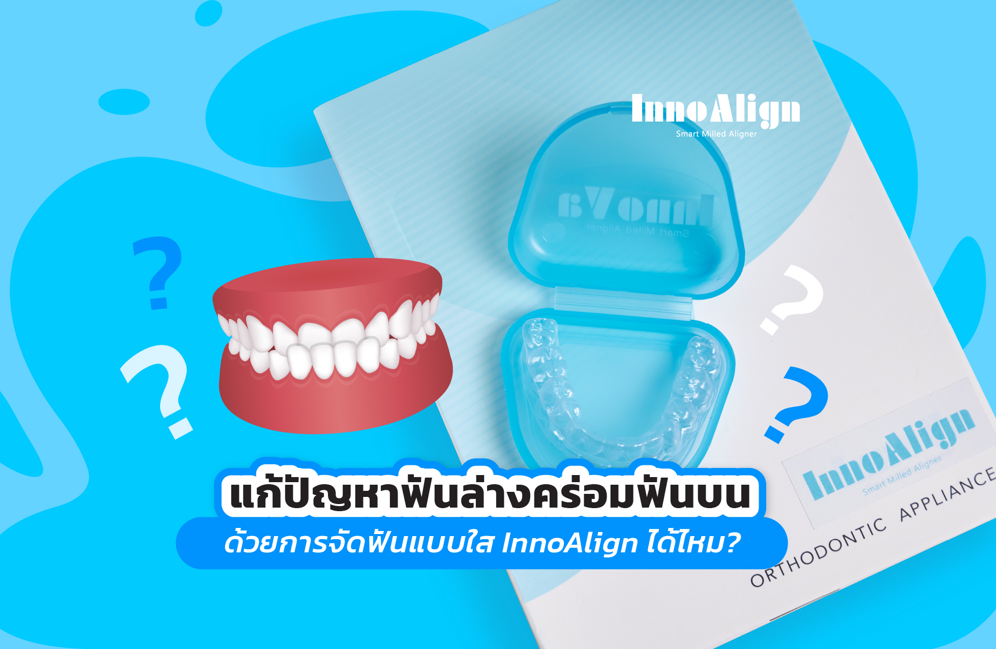 ปัญหาฟันล่างคร่อมฟันบน