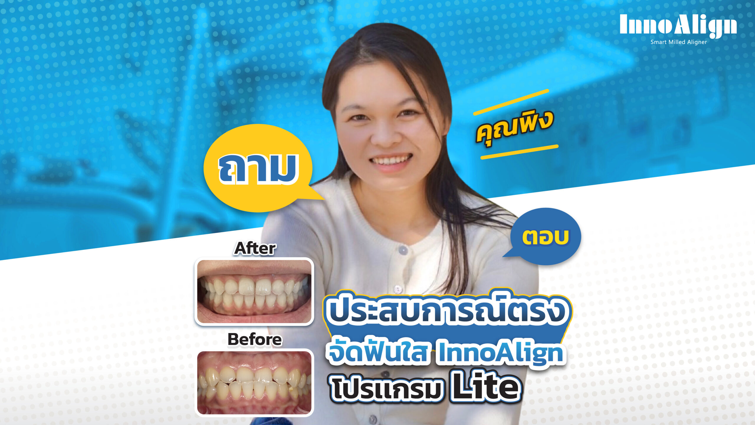 จัดฟันใส InnoAlign